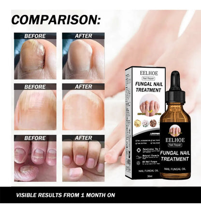 [OFERTA LIMITADA] - compra 1 y llévate 2 - PuroPie® – sensación de frescura, limpieza y pureza